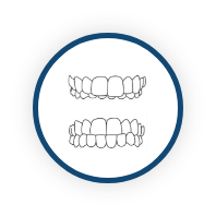 Overbite / Underbite